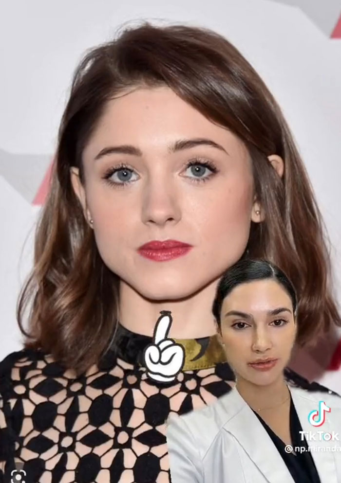 "This Is Why Everyone Looks The Same": People Slam This Nurse Injector For Giving Natalia Dyer A Face Transformation