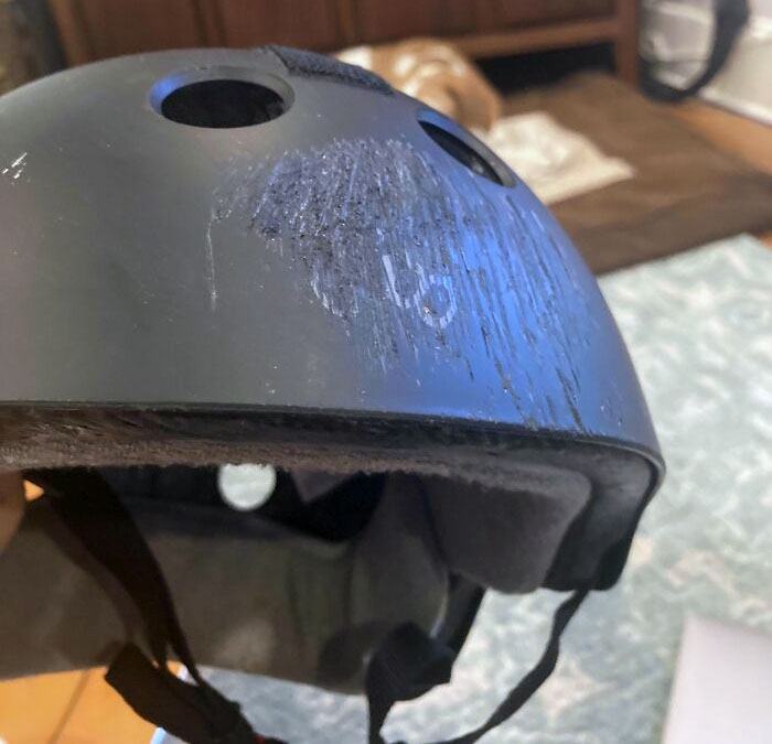 Reminder #122,824 To Wear A Helmet Folks