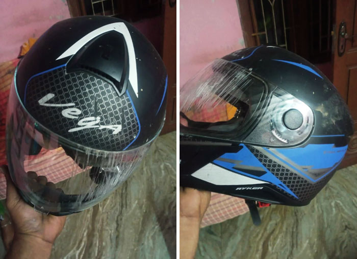 Those Scratches Could Have Been Serious Trauma And Damage To My Face, Jaw, And Head If Had It Not Been For The Helmet. I Wish More People Use Helmets