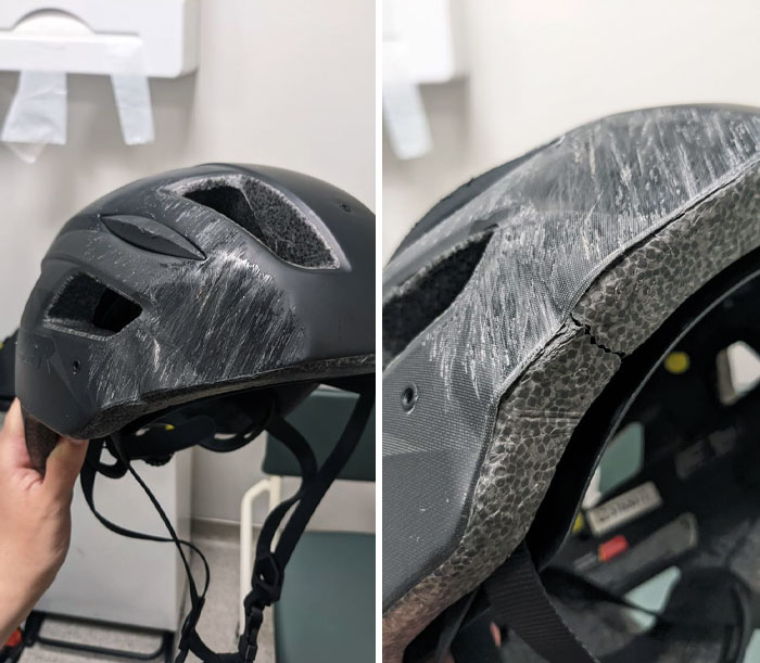 I Got Hit By A Car. Chances Are I Wouldn’t Have Made It If I’d Not Been Wearing A Good Helmet. Don’t Be A Helmet And Wear One