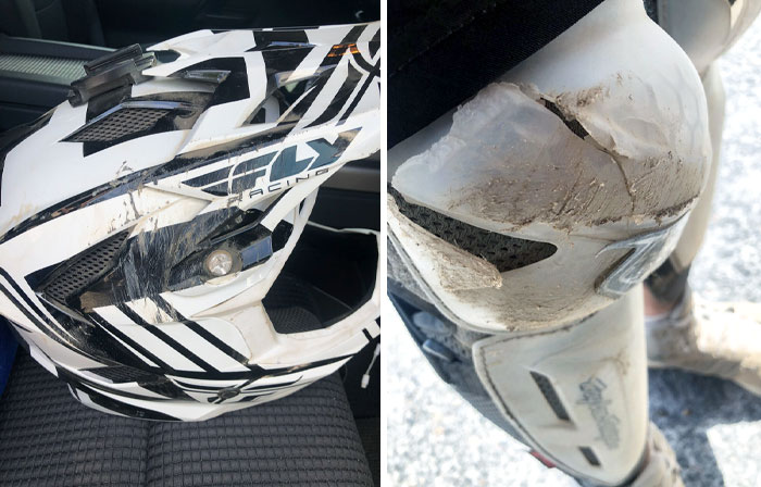 I Stumbled Onto A Couple Of Pictures From When One Of My Helmets Broke. The Broken Collar Bone And Broken Knee Guard Were Bonuses