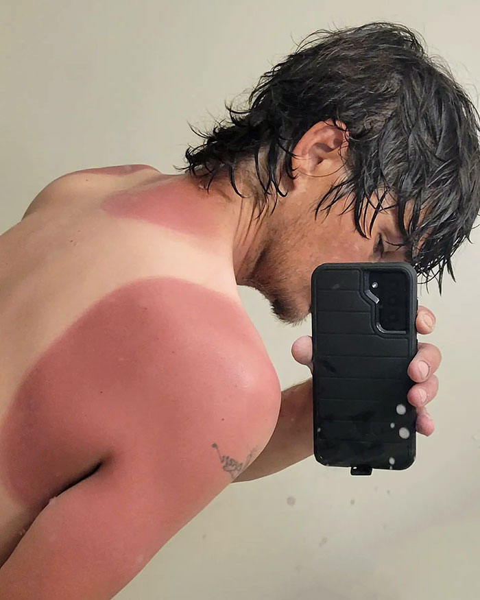 The Sun Almost Cooked Me Up For Breakfast