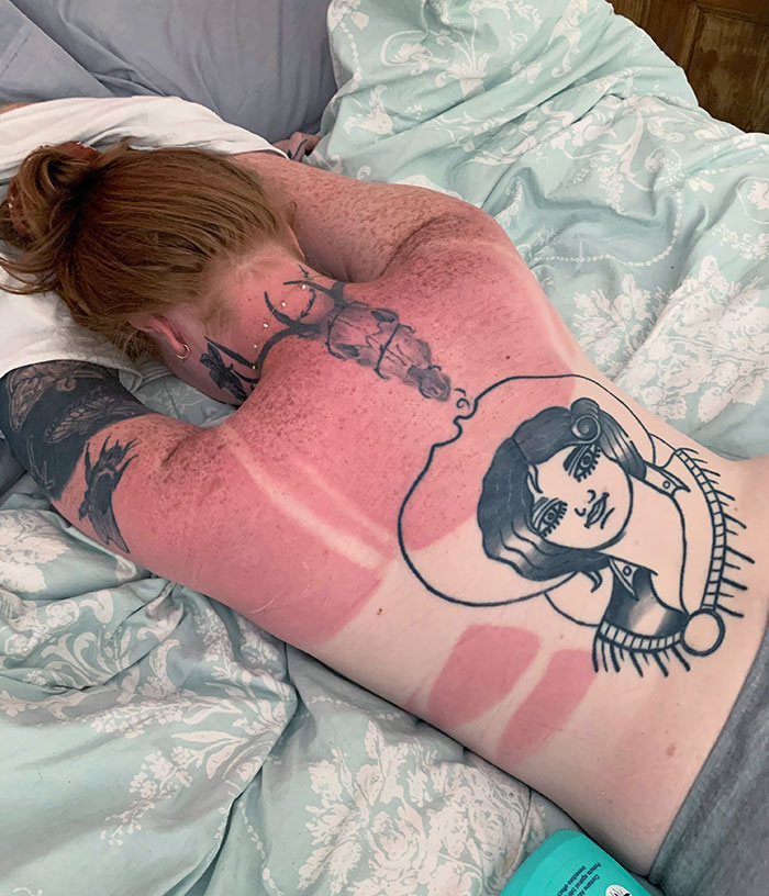 Less Than An Hour In The Sun, With Factor 50 And Factor 70 All Over Me