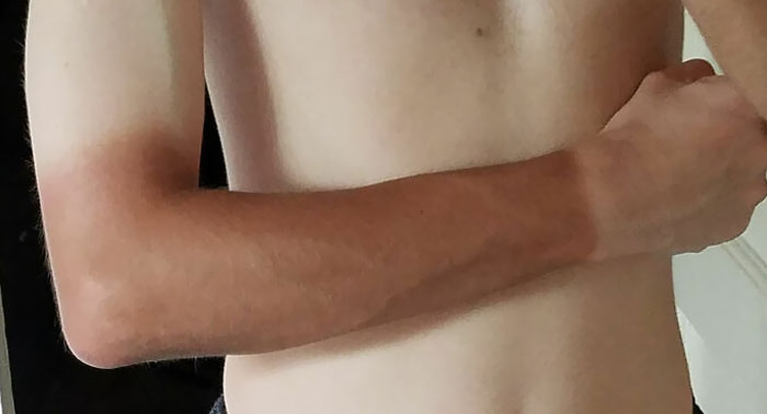 Got A New Job Where I Have To Wear A Uniform And Gloves While Working Outside, Now I Look Like This