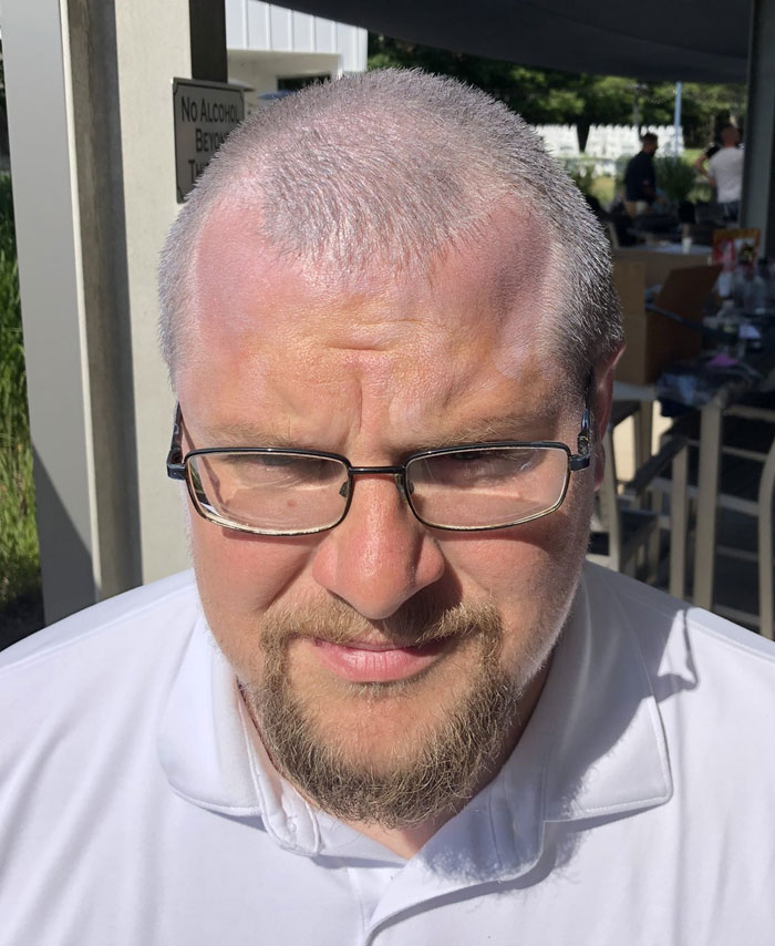 "Did I Rub All The Sunscreen In?"