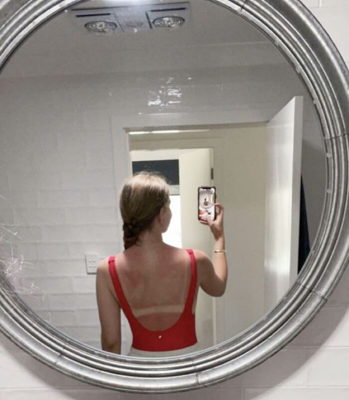 Please Remember To Re-Apply Sunscreen. I've Never Felt Crispier