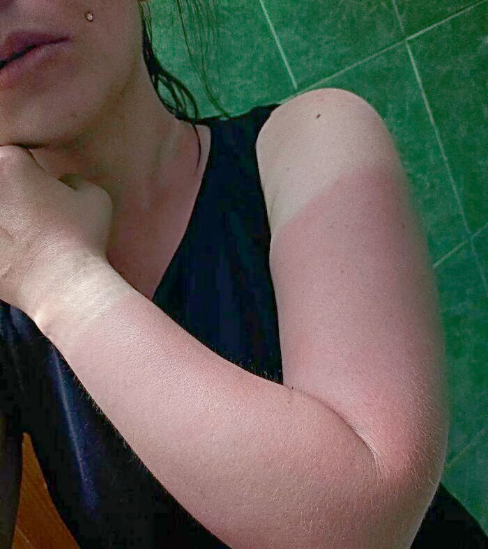 I Said I Wanted A Blacked Out Sleeve Tattoo And The Sun Gave Me A Free Trial