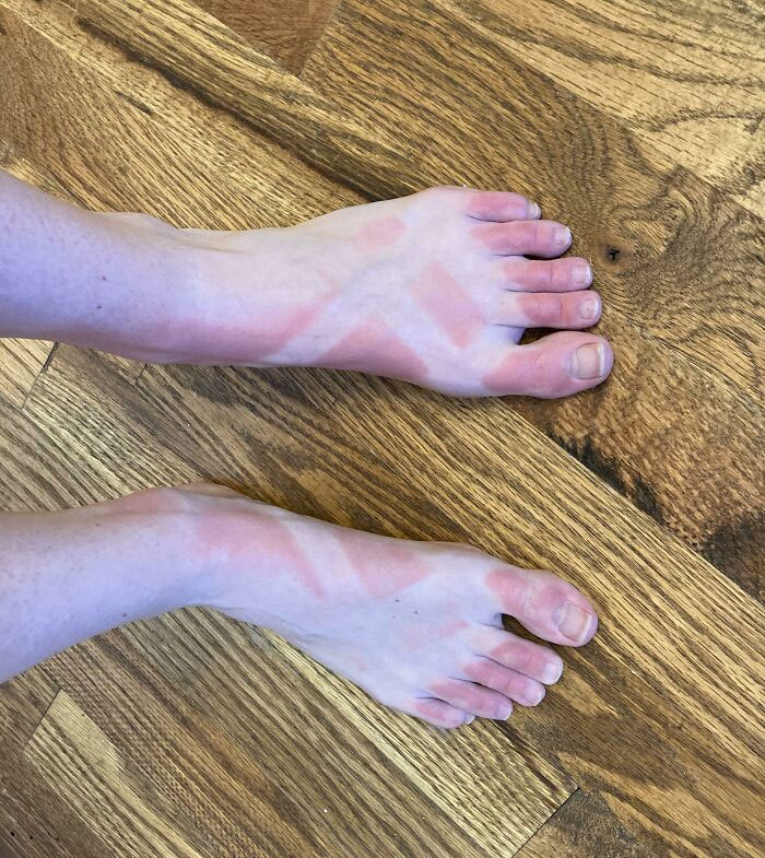 When You Thought Your Sunscreen Application Was Thorough Enough. An Outdoor Graduation Ceremony In Georgia Will Put Your In Your Place