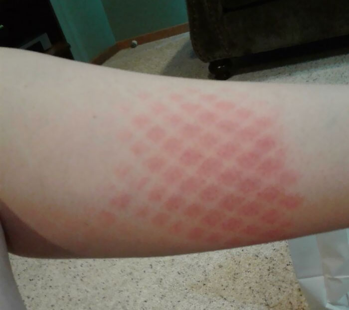 Fishnets Turned Me Into A Human/Snake Hybrid