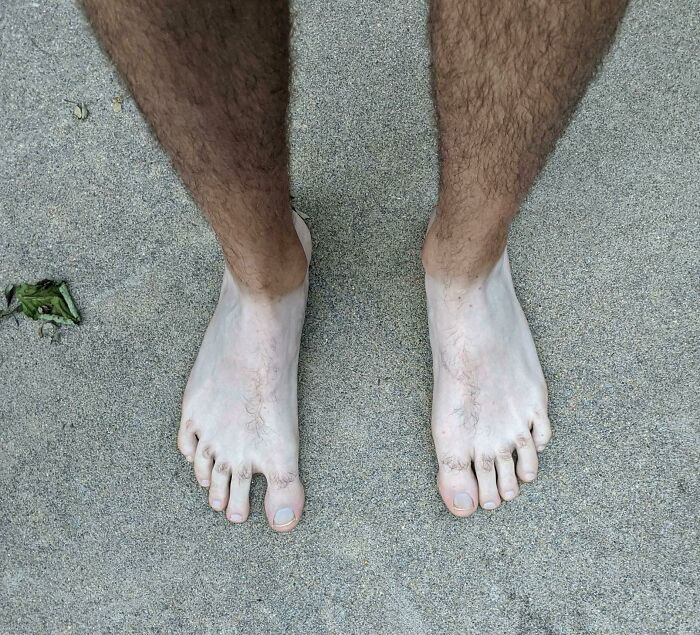 So You Thought The Roofer's Hand Tan Was Bad