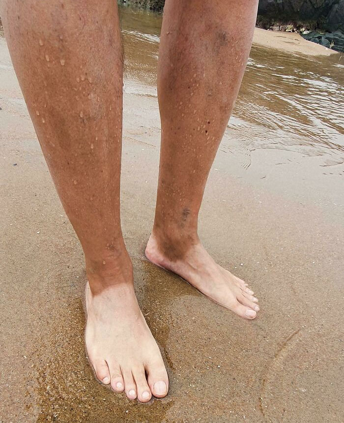 My Dad's White Feet And Tanned Legs. He Wears The Same Shoes Everyday