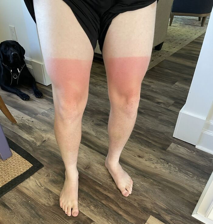 My Son Fell Asleep Sitting On A Beach Chair