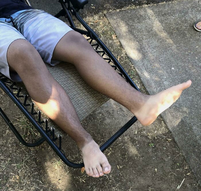 Tanned A Bit Too Much While Wearing Shoes. Kids Call Them My Chimp Feet