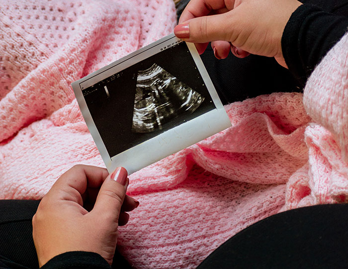 40 Wedding Horror Stories That Go From Bad To Yikes