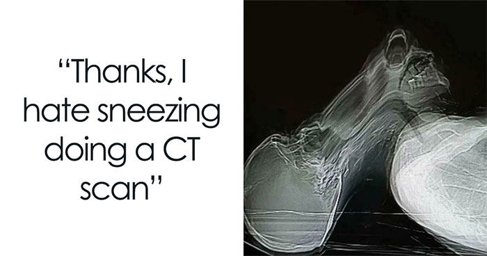 “Thanks, I Hate It”: 40 Unsettling Things That Nobody Wanted To See, As Shared By This Online Group (New Pics)