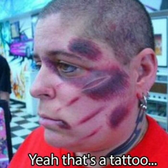 Person with a tattoo resembling bruises on their face, highlighting a tattoo fail.