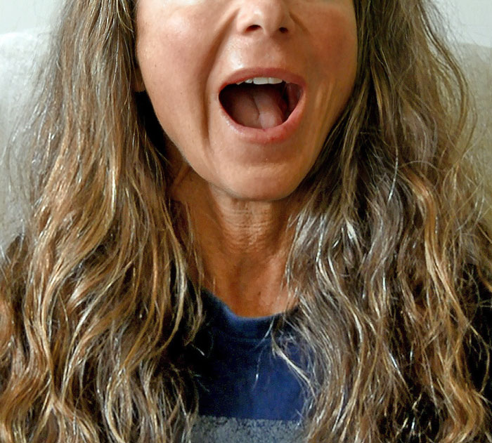 Only People With Rare Body Features Joined This Thread And Shared 35 Of Their Body Anomalies - 11