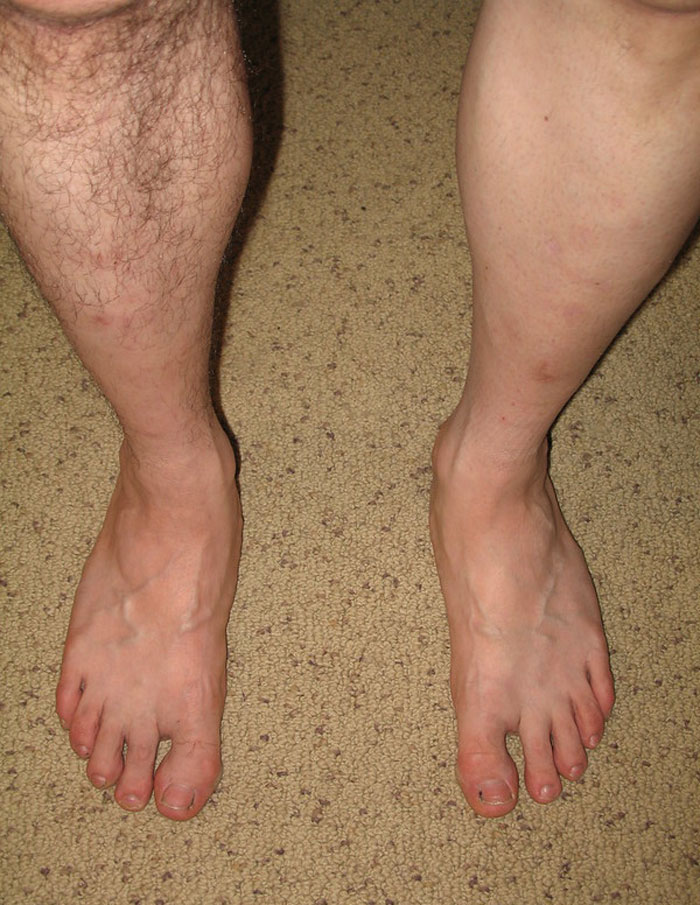 Only People With Rare Body Features Joined This Thread And Shared 35 Of Their Body Anomalies - 7