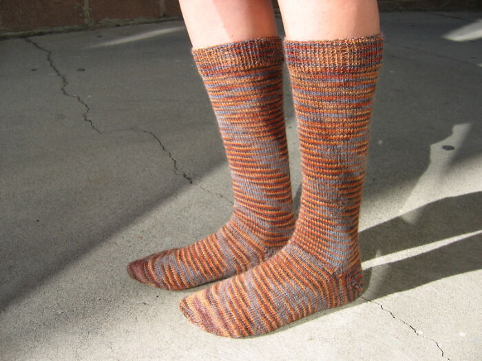 Only People With Rare Body Features Joined This Thread And Shared 35 Of Their Body Anomalies - 17