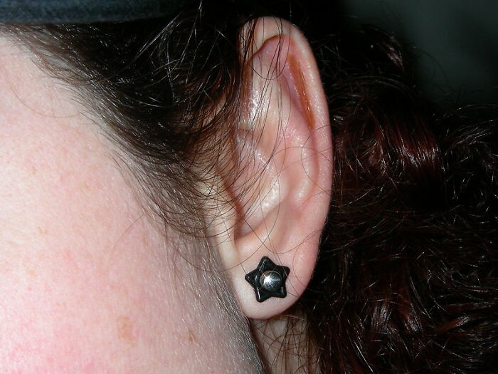 Only People With Rare Body Features Joined This Thread And Shared 35 Of Their Body Anomalies - 1