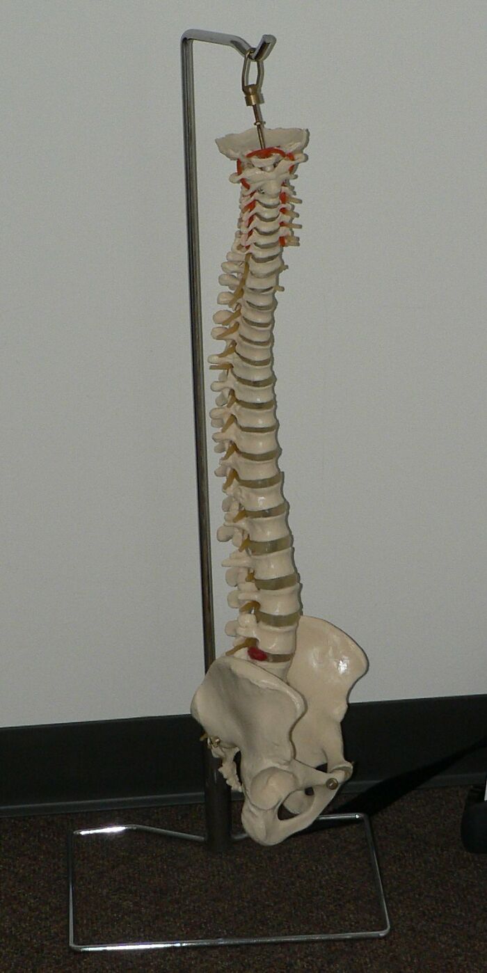 Only People With Rare Body Features Joined This Thread And Shared 35 Of Their Body Anomalies - 19