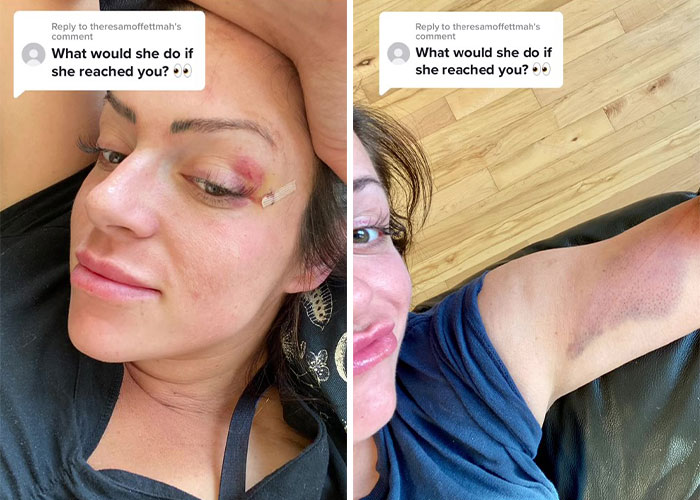 Millions Of People Can’t Get Enough Of The ‘Useless Farm’s’ Animals, Especially An Emu Named Karen, Who’s Out For Blood Millions Of People Can’t Get Enough Of The ‘Useless Farm’s’ Animals, Especially An Emu Named Karen, Who’s Out For Blood