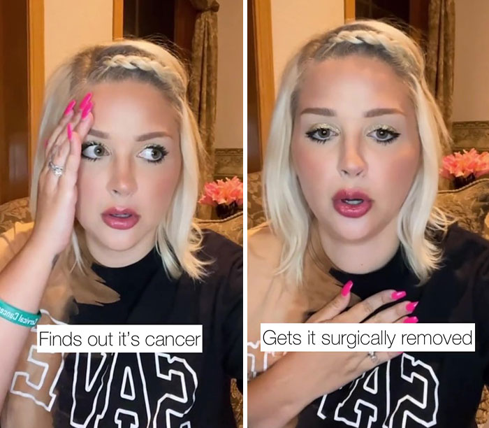 Woman Was Diagnosed With Cervical Cancer 3 Times And Shares The Hard And Joyous Days She Has On TikTok - 2