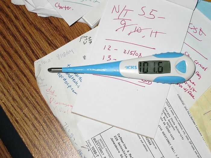 Only People With Rare Body Features Joined This Thread And Shared 35 Of Their Body Anomalies - 4