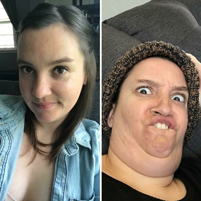 Oh Please God Send Help. My Neck Is Swallowing My Face!