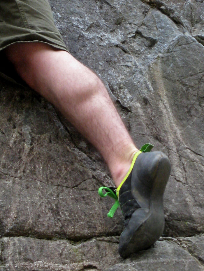 Only People With Rare Body Features Joined This Thread And Shared 35 Of Their Body Anomalies - 18