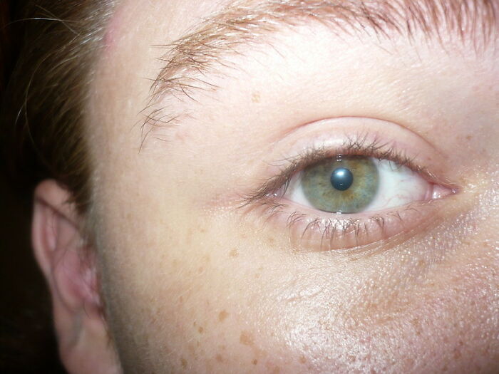 Only People With Rare Body Features Joined This Thread And Shared 35 Of Their Body Anomalies - 33