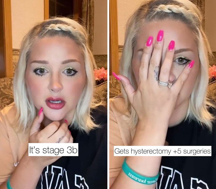 Woman Was Diagnosed With Cervical Cancer 3 Times And Shares The Hard And Joyous Days She Has On TikTok - 4