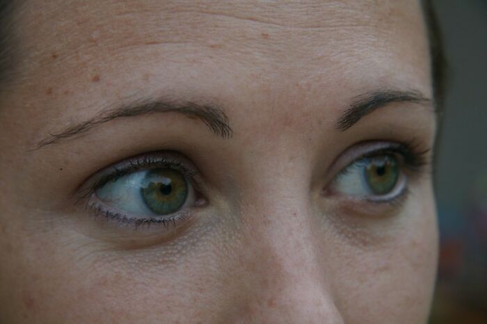 Only People With Rare Body Features Joined This Thread And Shared 35 Of Their Body Anomalies - 10