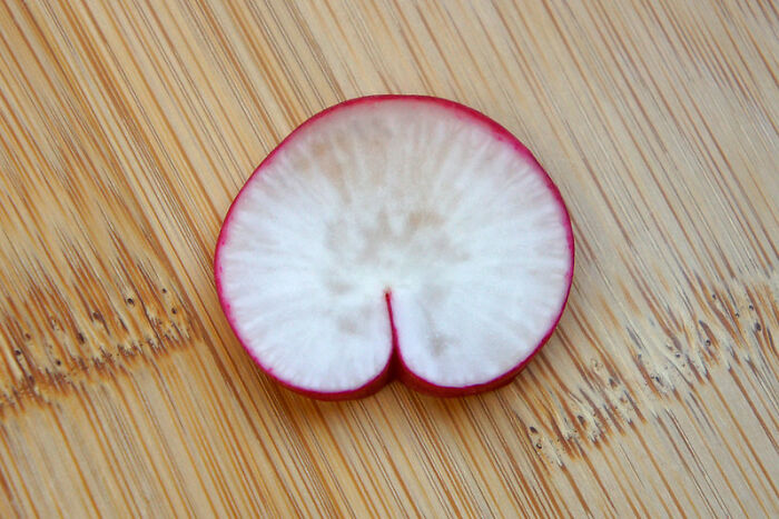 Only People With Rare Body Features Joined This Thread And Shared 35 Of Their Body Anomalies - 26