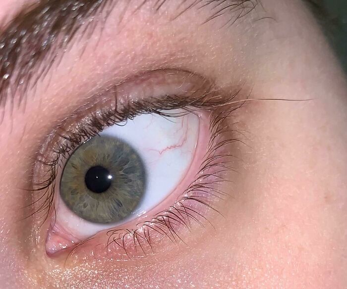 I Have One Eyelash That Has Grown Extra Long And Is Only Brown Up To Where It Should Have Stopped Growing