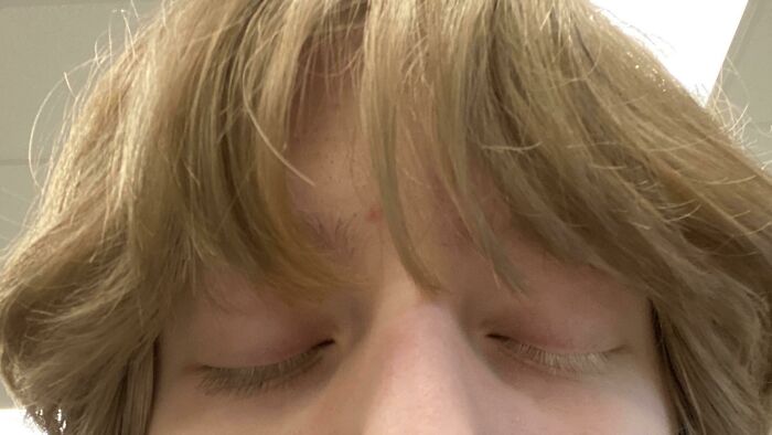 I Have Two Different Color Eyelashes And Was Born With Strawberry Blonde Hair