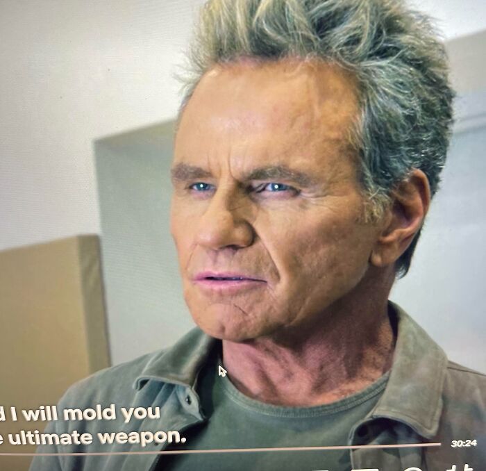 The Tone Match Here Is Awful