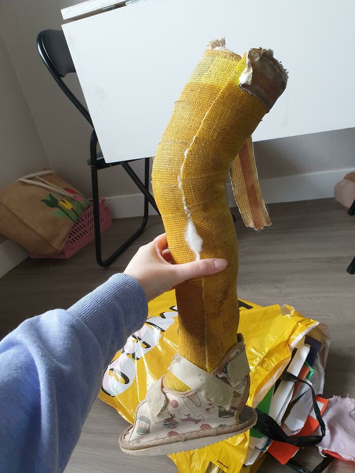 My Husband Broke His Leg When He Was 4 Years Old. He Kept The Cast