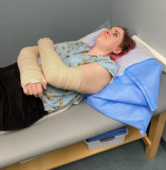 New Hobby = New Broken Bones. 30 Seconds After Putting On Roller Blades Resulted In 2 Broken Wrists