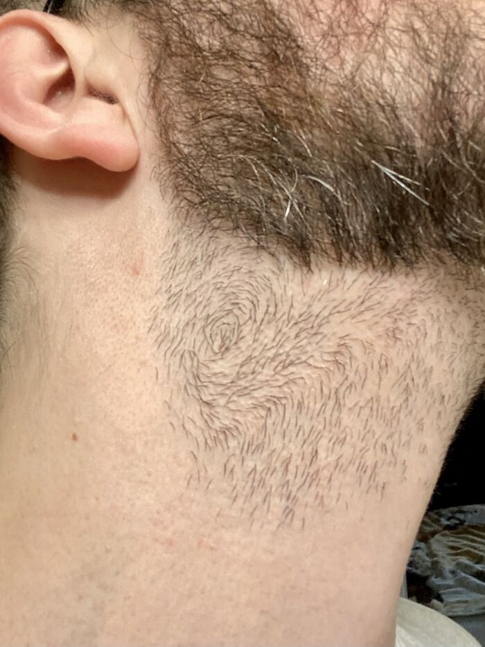 My Neckbeard Grows In A Spiral