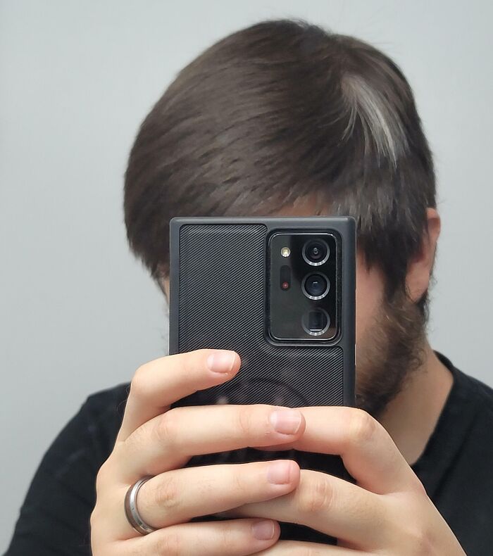 Only A Certain Patch Of My Hair Went Grey