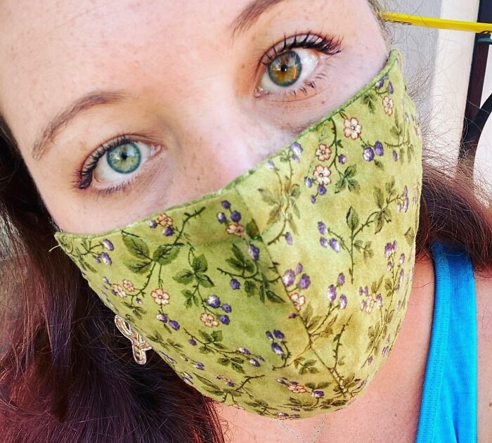 I Have Full Heterochromia