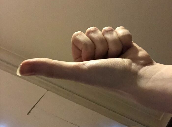 I Have Somewhat Long Thumbs