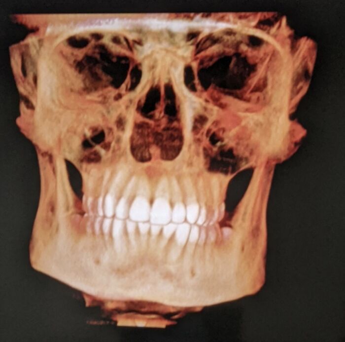 I Have A Really Square Head