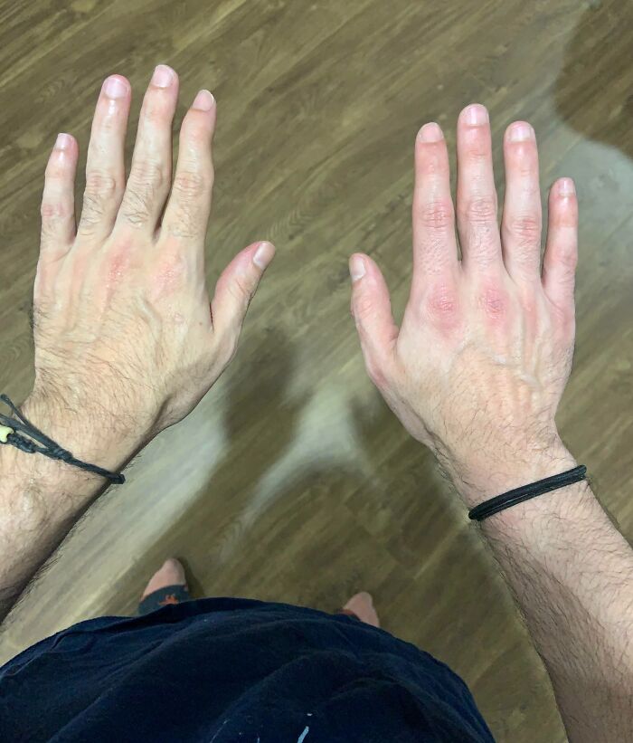 Each Of My Hands Are Different Size, Shape And Color