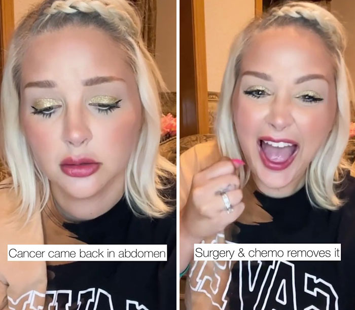 Woman Was Diagnosed With Cervical Cancer 3 Times And Shares The Hard And Joyous Days She Has On TikTok - 7