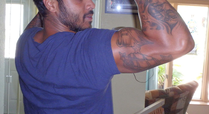 Only People With Rare Body Features Joined This Thread And Shared 35 Of Their Body Anomalies - 22