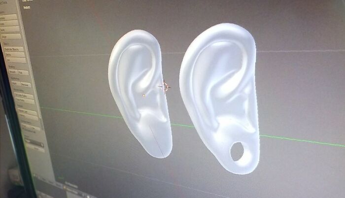 Only People With Rare Body Features Joined This Thread And Shared 35 Of Their Body Anomalies - 27