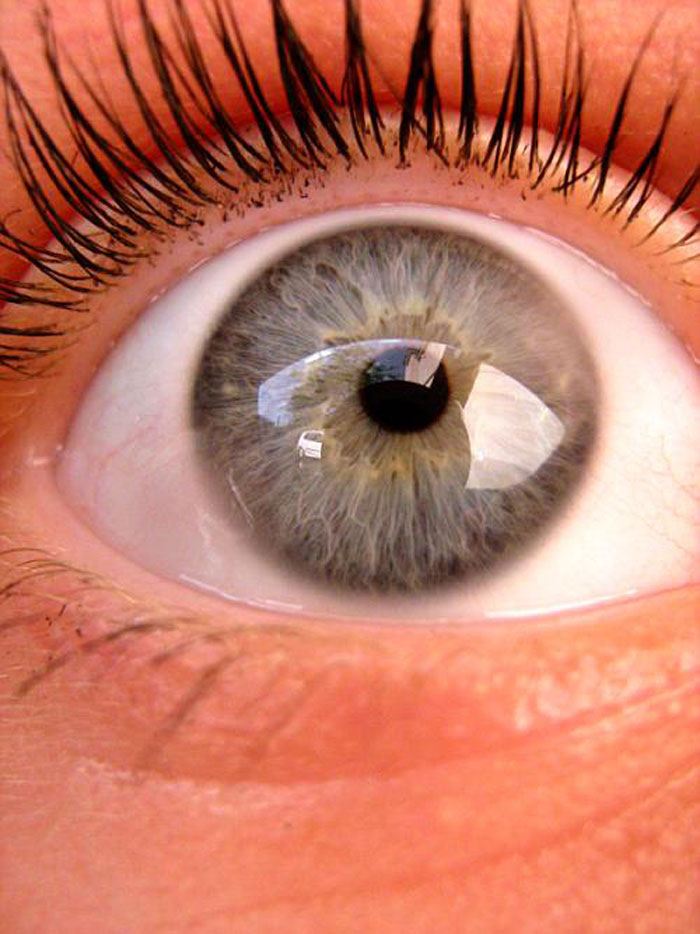 Only People With Rare Body Features Joined This Thread And Shared 35 Of Their Body Anomalies - 30