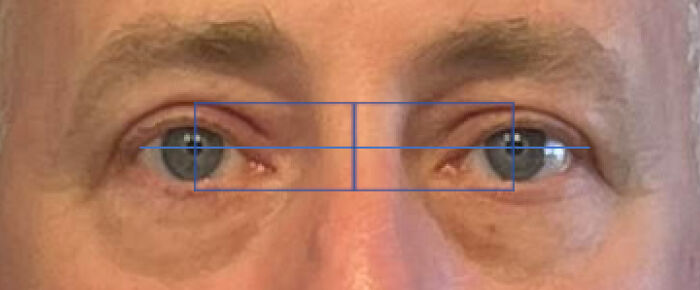 Only People With Rare Body Features Joined This Thread And Shared 35 Of Their Body Anomalies - 9